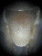 subgenital plates males