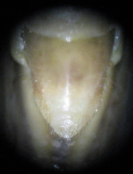 subgenital plates comparing males Oecanthus beameri and Oecanthus quadripunctatus